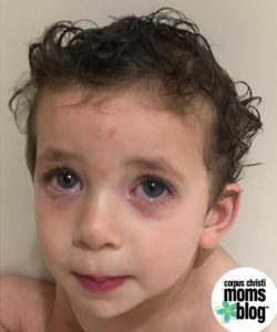 Sick Kid. Sick Family- Flu, Eye Infection, Ear Infection- Corpus Christi Moms Blog